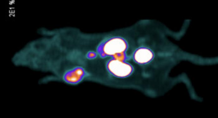New tracer could enable surgeons to see and hear prostate cancer