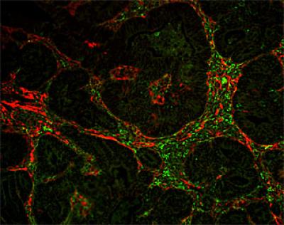 Myofibroblasts