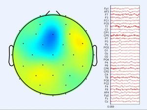 Brain Waves monitoring
