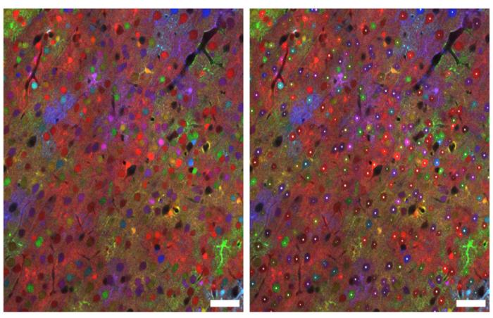 Two-dimensional slice of a mouse brain region with fluorescent markers