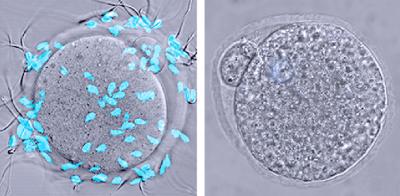 Sperm Attach to Egg