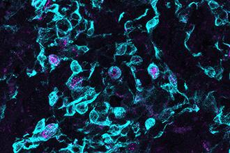 Microscopic View of the Thymus