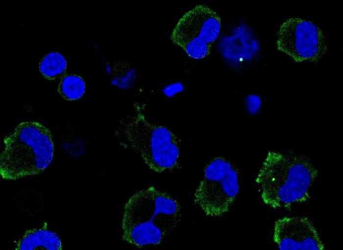 Combating exaggerated inflammation