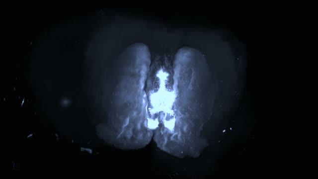 3-D Rotating Brain Video -- Part of the VR Experience