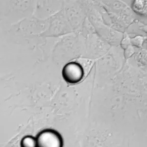 Microbead laser inside cell