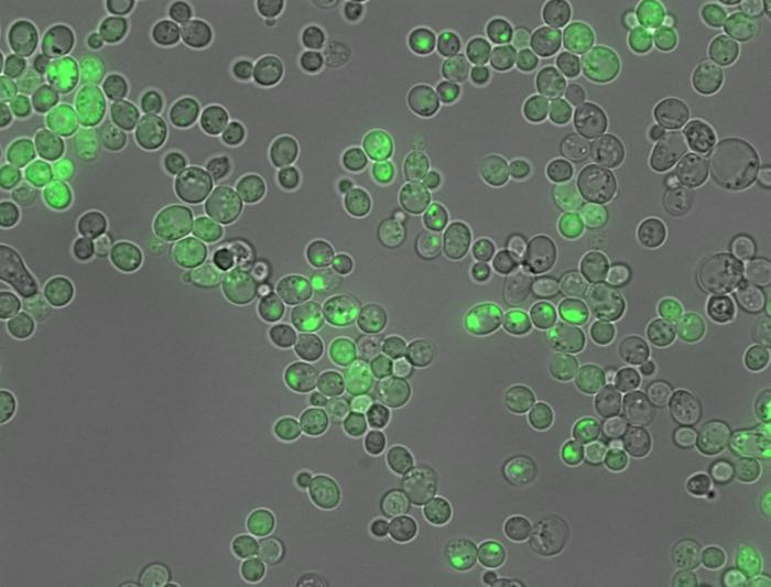 Amyloid aggregation inside cells