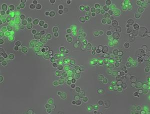 Amyloid aggregation inside cells