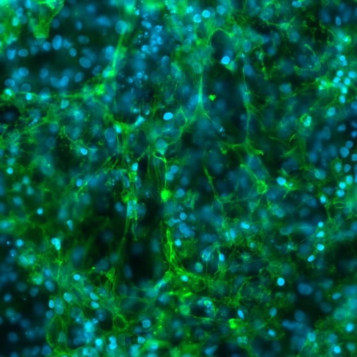 Heart cells