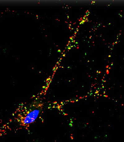iPSC Cortex Neuron