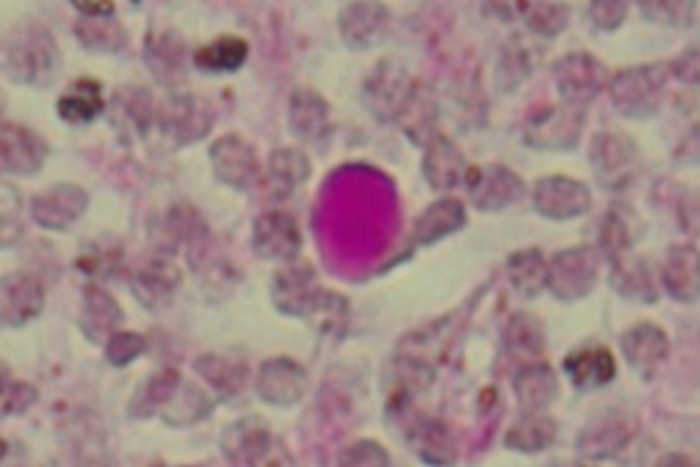 WASTEOSOMES