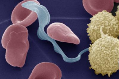 X-rays Expose Blueprint for Possible Sleeping Sickness Drug (2 of 3)