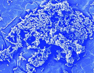 Microbe's Secret Language