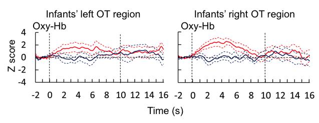 Time Course of Brain Activity