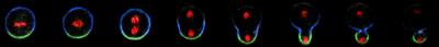 Dividing Stem Cell (Drosophila Neuroblast)