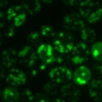 Wild Type Yeast Cells after Heat Shock