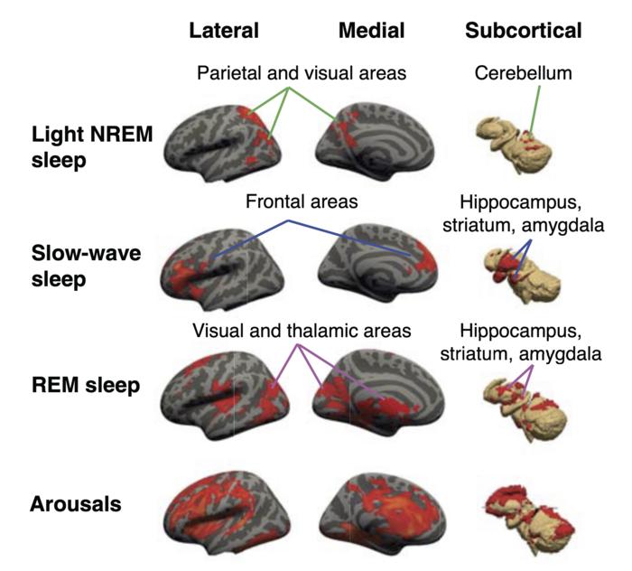 Sleep stages and brain activity