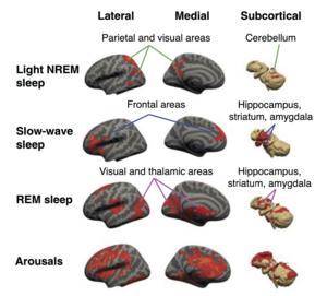 Sleep stages and brain activity