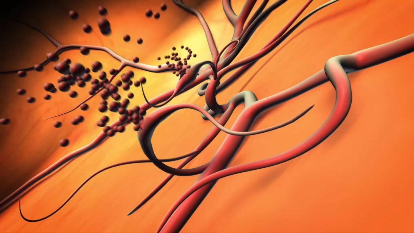 Leaking Blood Vessels