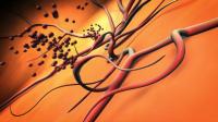 Leaking Blood Vessels