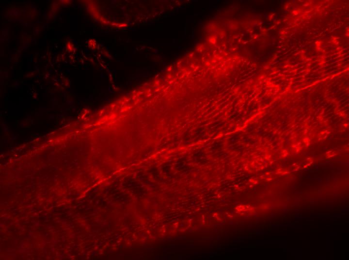 Vinculin May Keep Us Young at Heart (3 of 3)