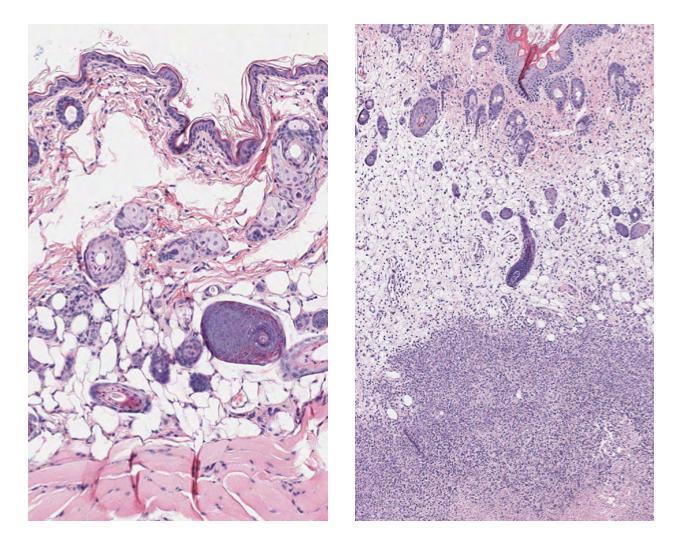 Mouse Tissue With & Without Group A Streptococcus Infection
