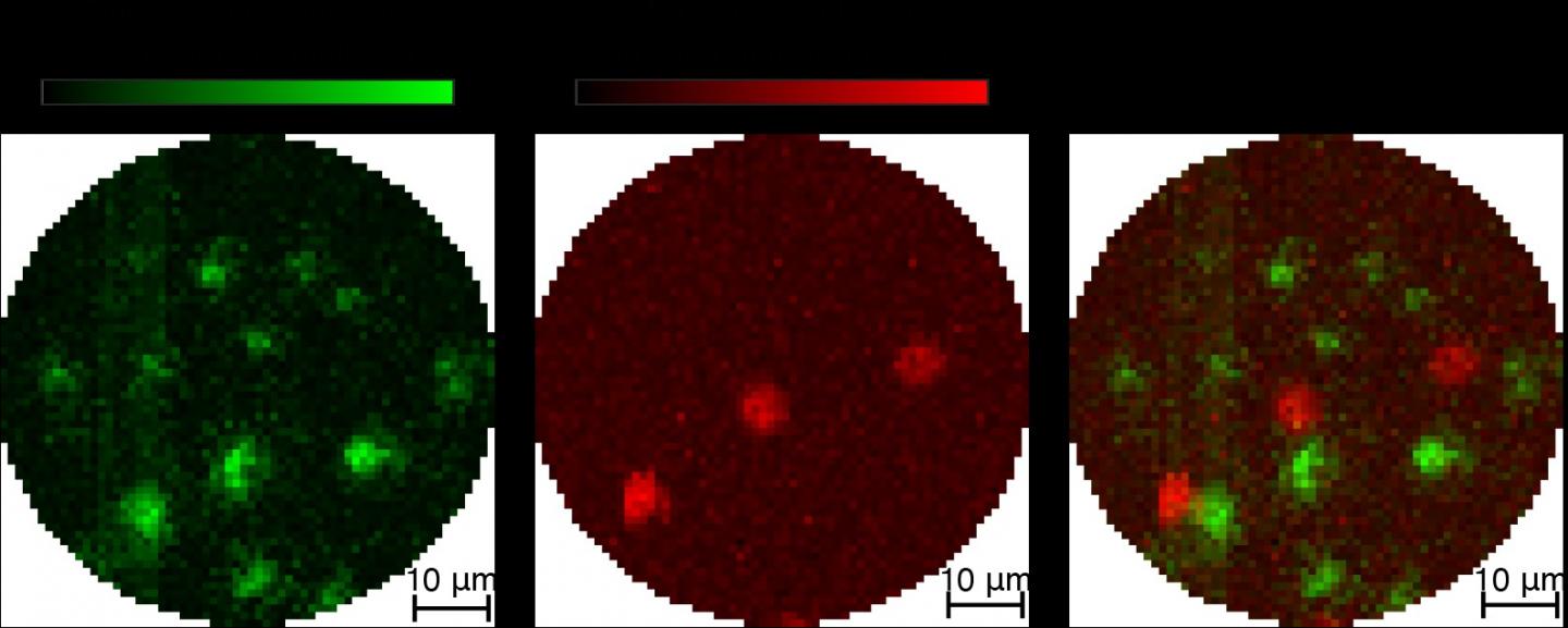 Fluorescence and Photoacoustic Images