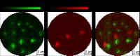 Fluorescence and Photoacoustic Images