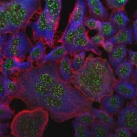 Cancer Cells