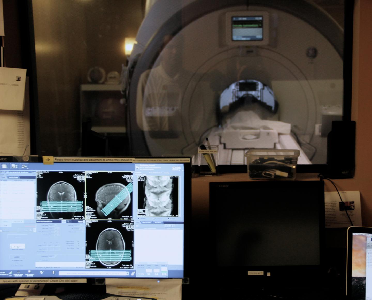 One Part of the Brain Unexpectedly Continues to Grow in Adulthood (2 of 7)