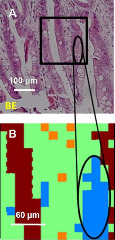 Synchrotron Infrared Microscope Image of Barrett's Esophagus Tissue