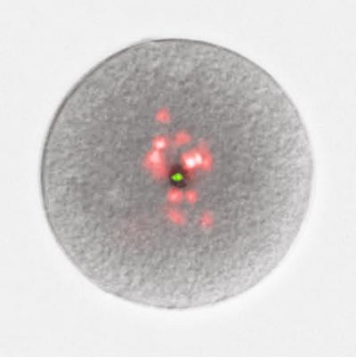 Centrosomal RNAs in Spisula Oocyte
