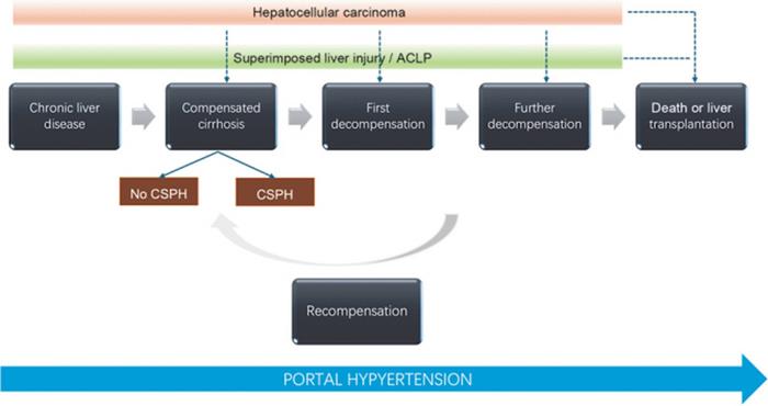 Summary of the natural history of cirrhosis