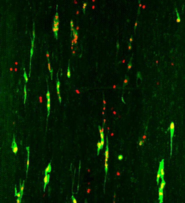 This image shows fibroblasts which were cultured with cancer cells to study the invasion of these cells in such a biopolymer based tissue.