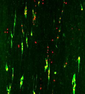 This image shows fibroblasts which were cultured with cancer cells to study the invasion of these cells in such a biopolymer based tissue.
