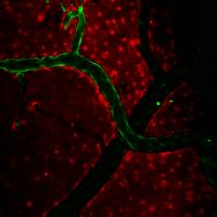 In-Vivo 2-Photon Microscopy Image of Endothelial Cells Lining Surface Arteries in the Brain