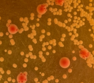 Klebsiella pneumoniae and Acinetobacter baumannii growing together