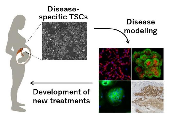 Potential applications of hTSCs in the study of pregnancy complications
