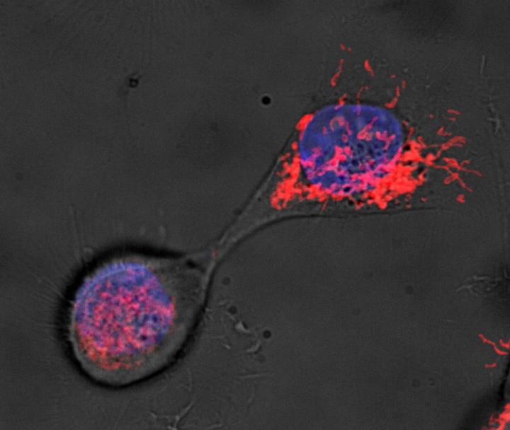 Human Mammary Stem-Like Cell Apportions Aged Mitochondria Asymmetrically between Daughter Cells