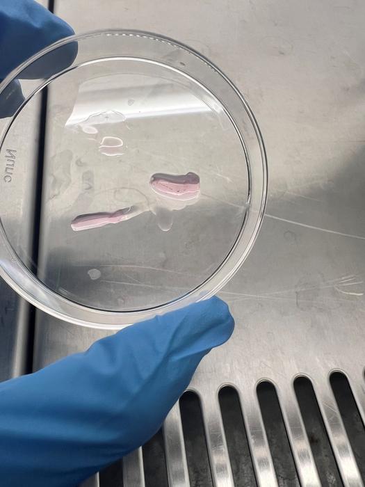 Engineered heart tissues in a petri dish after being removed from the posts