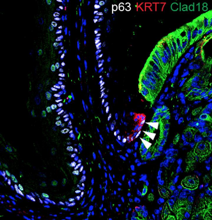 Unique Basal Progenitor Cells