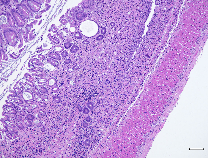 UTSW researchers discover new drug target for inflammatory bowel disease
