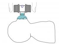 Portable Device Helps Breathing during First Seconds of Life