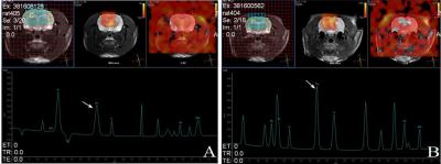 Proton Magnetic Resonance Spectroscopy