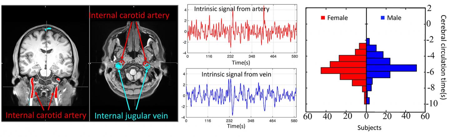 Imaging Technology Detects and Monitors Cerebral Vascular Disorders, Injuries in Brain
