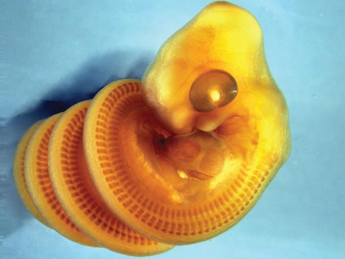 Snake coil1 - Boaedon capensis embryo