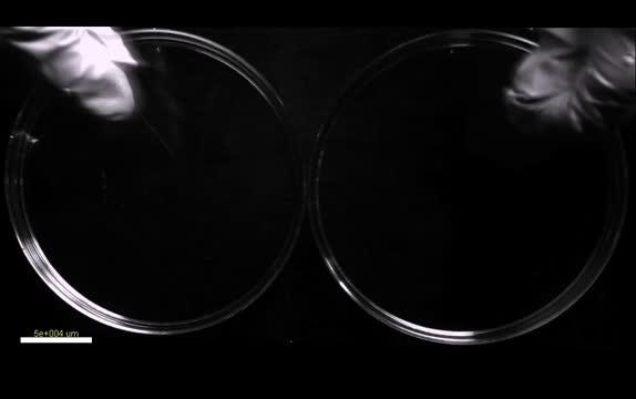 Gas-Propelled Microparticles Travel Deep into Wounds to Stop Bleeding (2 of 4)