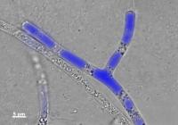 <i>Pythium ultimum</i> (2 of 2)