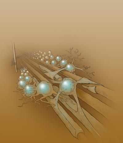 Neural Stem Cell Therapy for Rare Brain Disorders