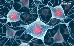 BGI Genomics study Uncovers Brain Damage Progression in Alzheimer's Disease