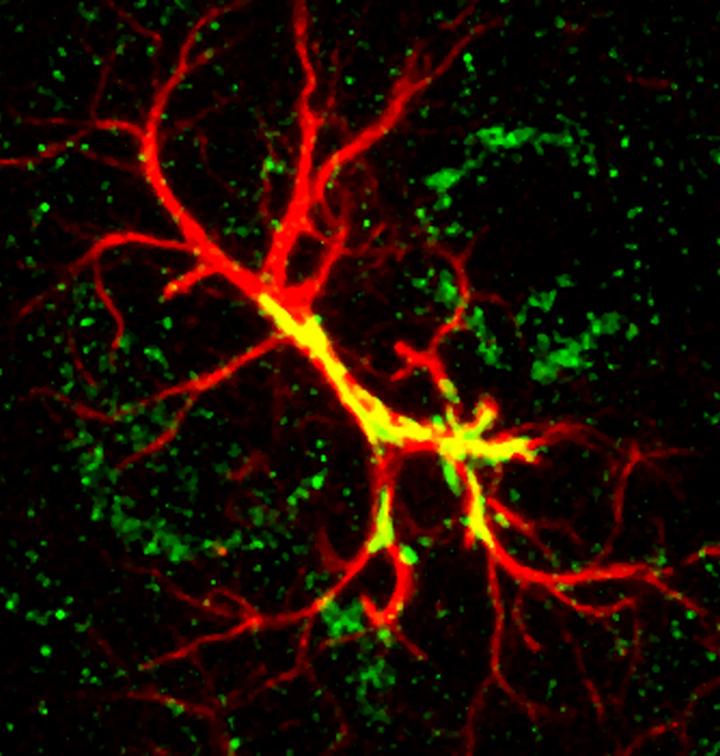 Astrocyte
